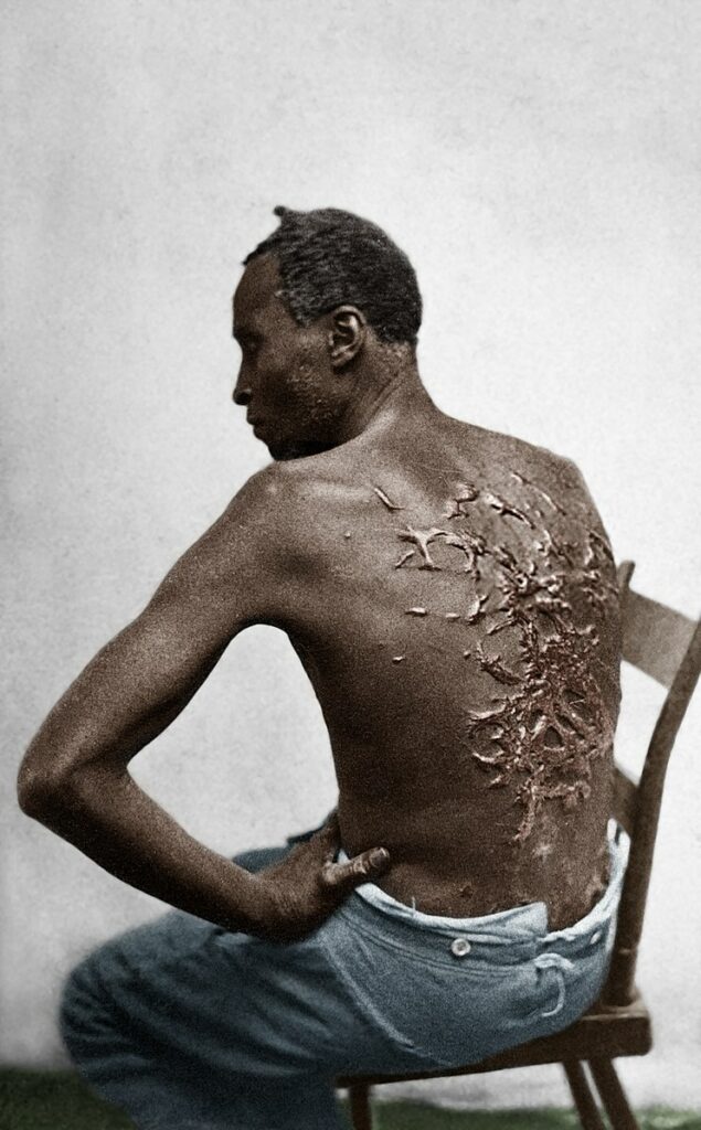 Emancipation vs. the True Story of Whipped Peter, Runaway Slave